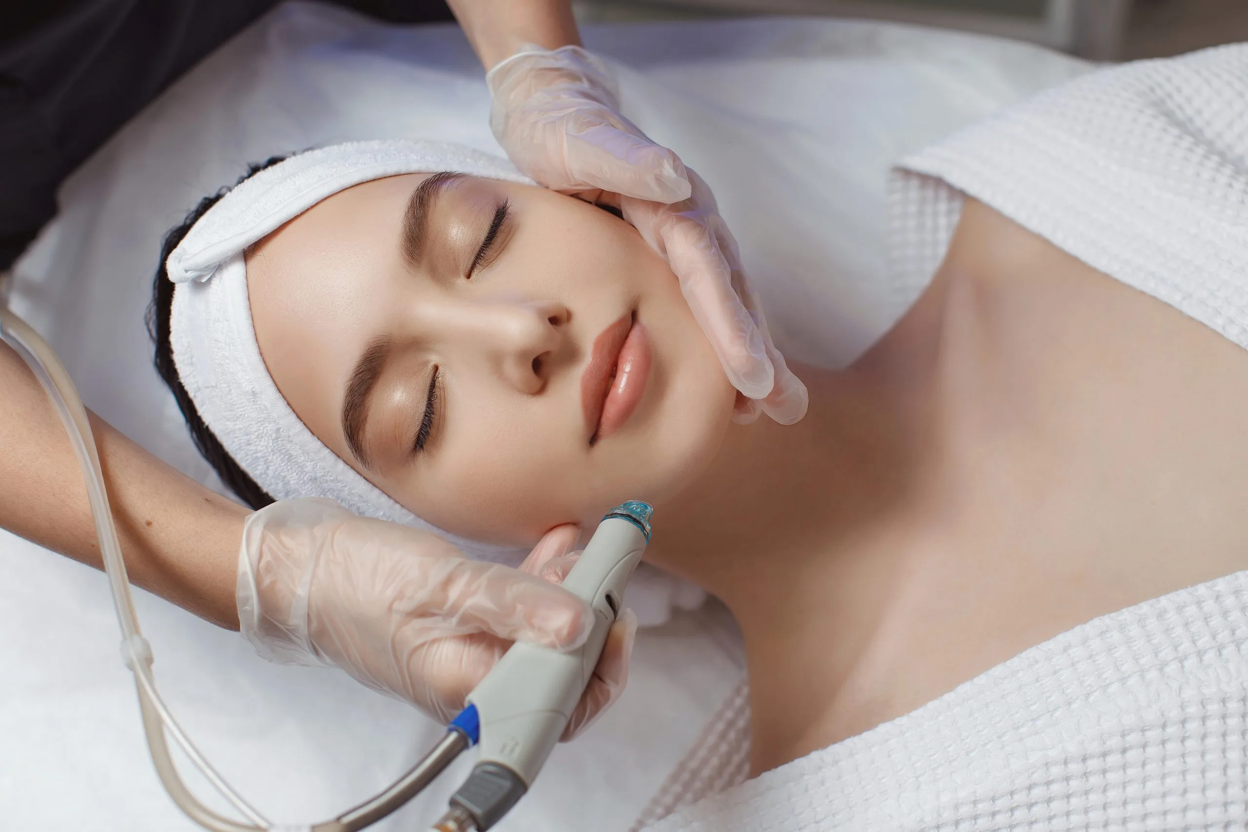 Laser Treatment for Acne in Mission Viejo, CA by MedGlo