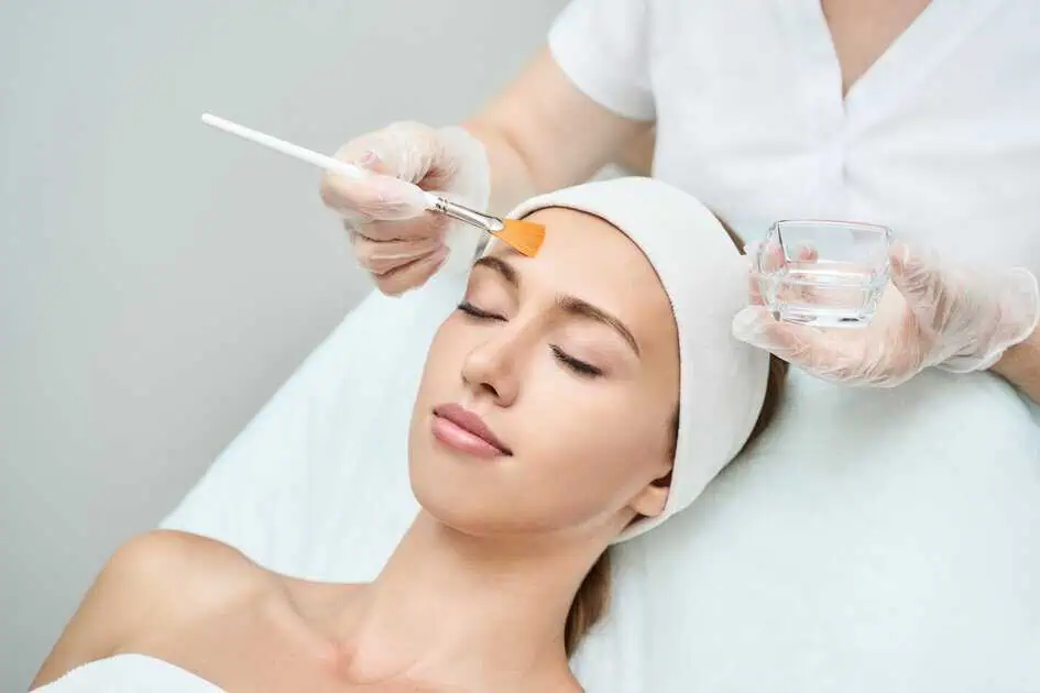 chemical peels in Mission Viejo, CA by Violeta Recalde